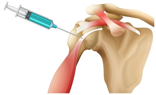 Best Shoulder Surgery in Ghaziabad