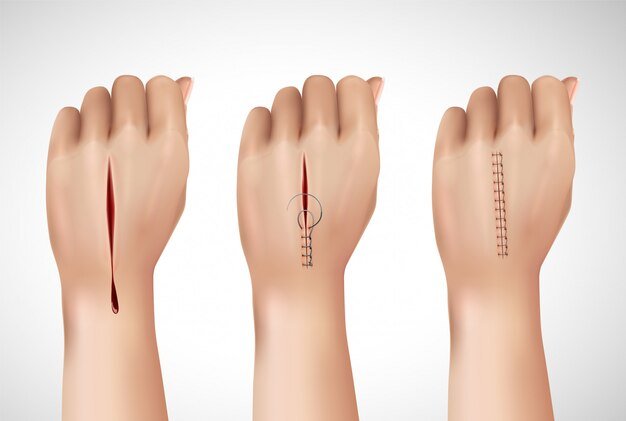 Best Hand Surgery in Ghaziabad