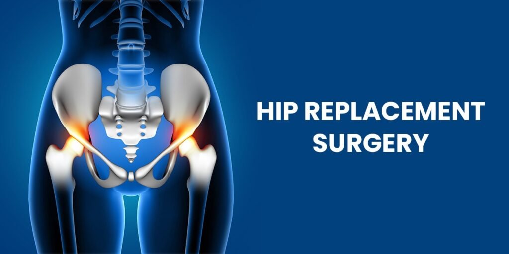 Hip Replacement Surgery in Sahibabad