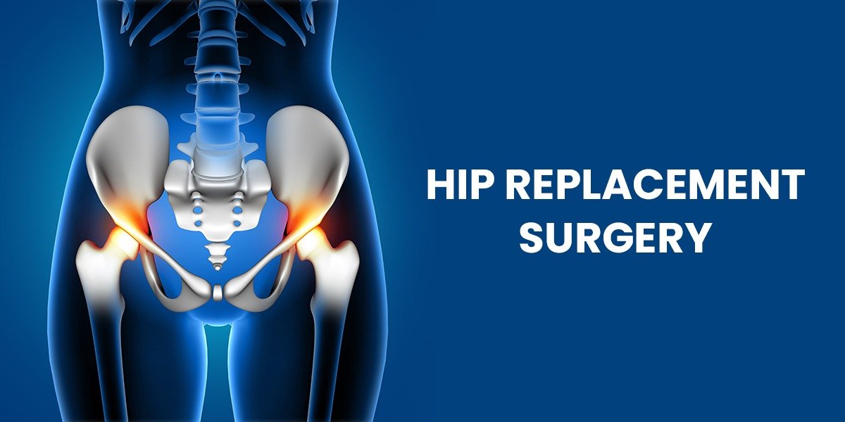 Hip Replacement Surgery in Sahibabad