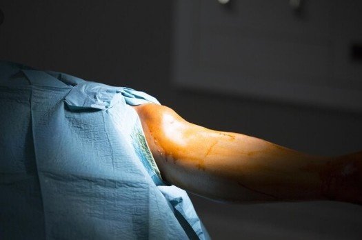 Best Elbow Surgeon Doctors in Ghaziabad