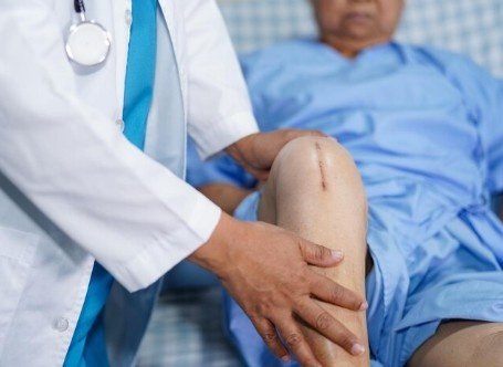 Best Knee Replacement Surgeon in Lajpat Nagar