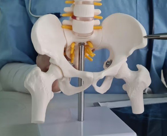 Best Hip Replacement Surgery in Ghaziabad