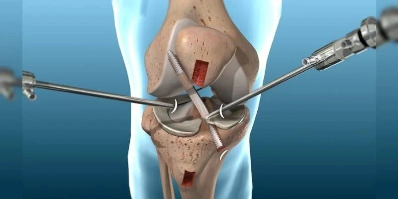 Best Arthroscopic Surgery in Ghaziabad