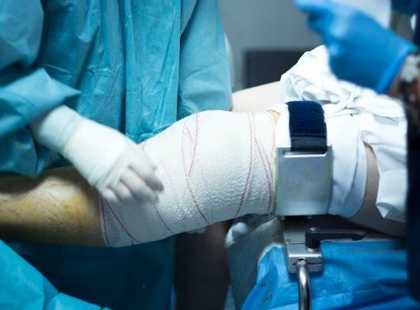 Best Elbow Replacement Surgeons in Ghaziabad