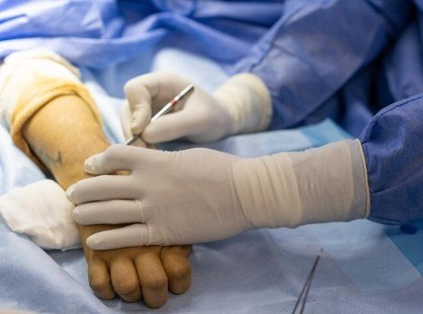 Best Hand Surgery Doctors in Ghaziabad