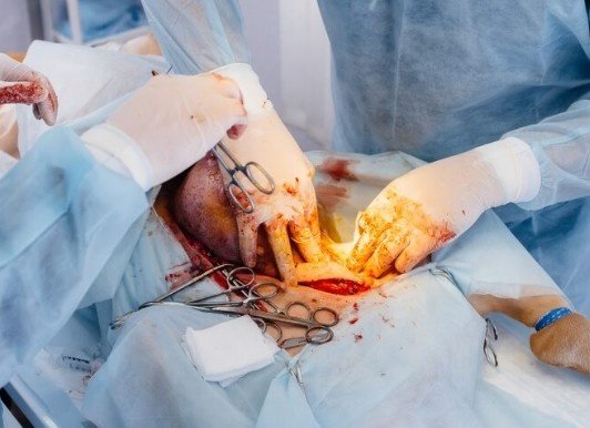 Best Doctors For Complex Trauma Surgery in Sahibabad