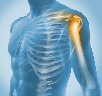 Best Doctors For Shoulder Surgery in Ghaziabad