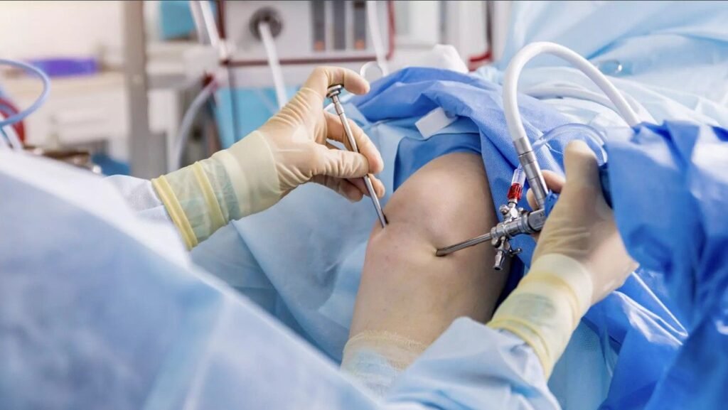 Best Arthroscopic Surgery in Ghaziabad