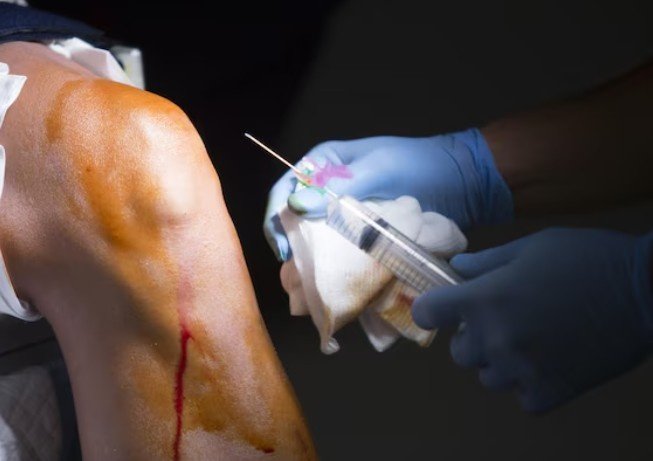 Best Elbow Surgery in Ghaziabad